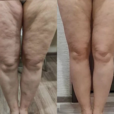 Foto de Ana, 48 años